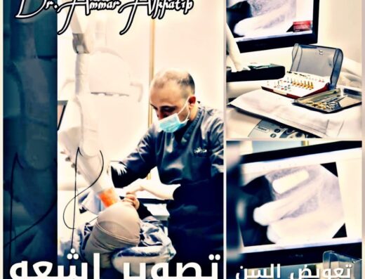 مركز الدكتور عمار الخطيب لطب وجراحة الأسنان – Dr. Ammar Al Khatib Dental Center
