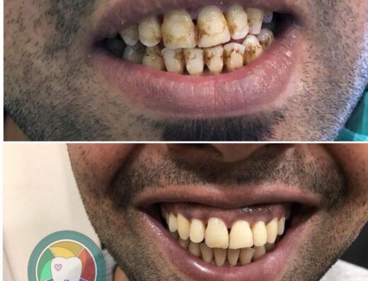 طوارئ اسنان ٢٤ ساعة – عيادة اسنان – عيادة الدكتور محمد البو