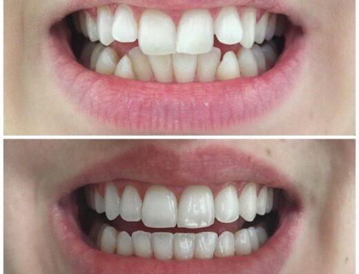 Esthetic Dental Center- Amman Jordan